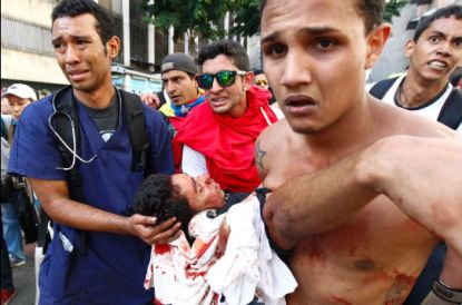 http://worldmeets.us/images/Venezuela-protest-injury-2014_pic.jpg