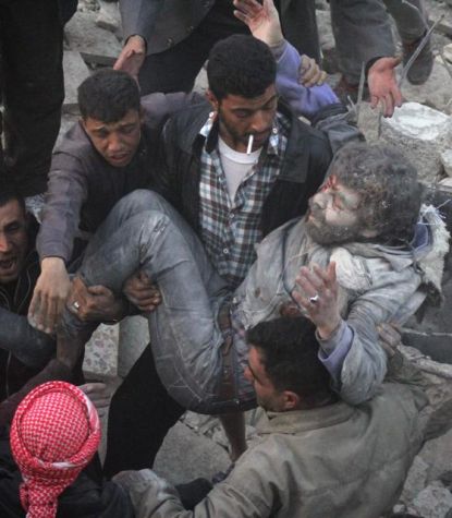 http://worldmeets.us/images/syria-aleppo-man-injured_pic.jpg